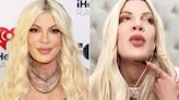 Tori Spelling Gets 6 Stitches on Chin After Fainting, Jokes She Should've Asked Doc ‘Make It a Little Tighter’