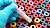 Pfizer’s haemophilia A gene therapy shows promise, but tough rivals ahead