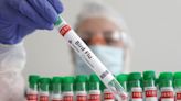 China registra la primera muerte humana por gripe aviar H3N8 -OMS