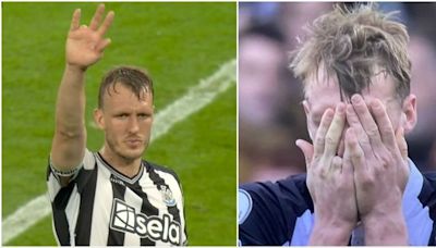 The horrifying story behind Dan Burn's missing finger as fans notice his right hand v Man Utd