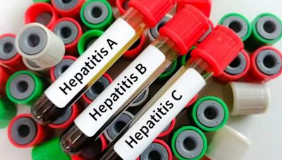 Most Common Type Of Hepatitis In India; Expert Shares Tips To Manage