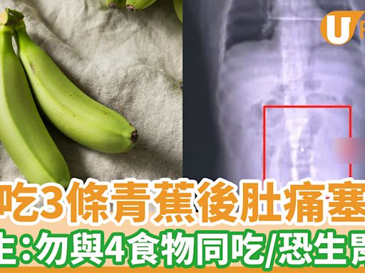 男子連吃3條青蕉肚痛塞腸 醫生：勿與4食物同吃 可生胃石 | U Food 香港餐廳及飲食資訊優惠網站