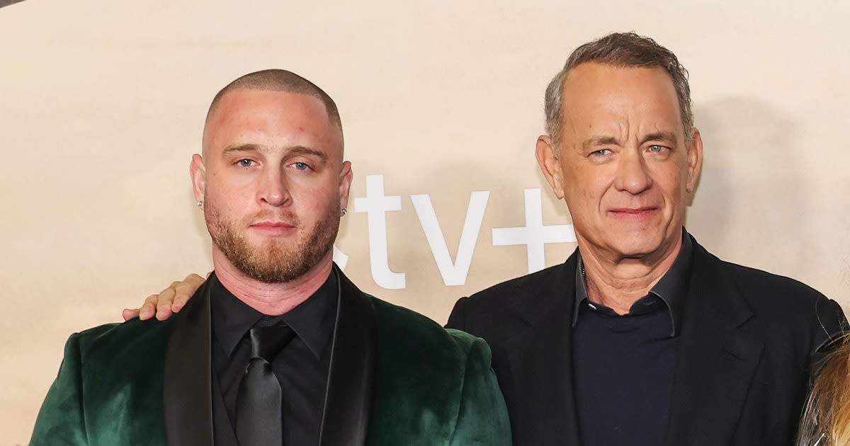 Tom Hanks’ Son Chet Hanks Got His Forehead 'Blasted With Botox'