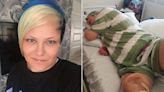 Mom Begs Doctors to Amputate After a 'Simple Scratch' on Her Thigh Leads to 55 Surgeries: 'I Just Want My Leg Off'