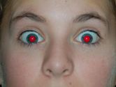 Red-eye effect