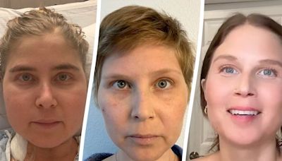 Woman Thinks She's Having an Allergic Reaction — but It’s a Rare Cancer That Affects One in 1 Million People