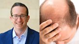 A dermatologist affected by minoxidil shortages shares 3 ways hair loss patients can access the drug