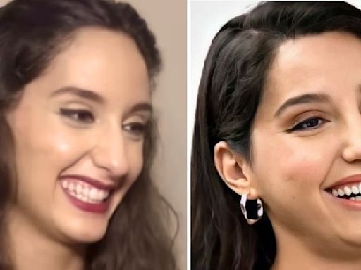 Nora Fatehi Before Surgery? Old Video Has People Debating If She Has Gone Under The Knife