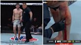 Jack Shore's gruesome leg injury at UFC 301 led to one of the most bizarre fight endings ever