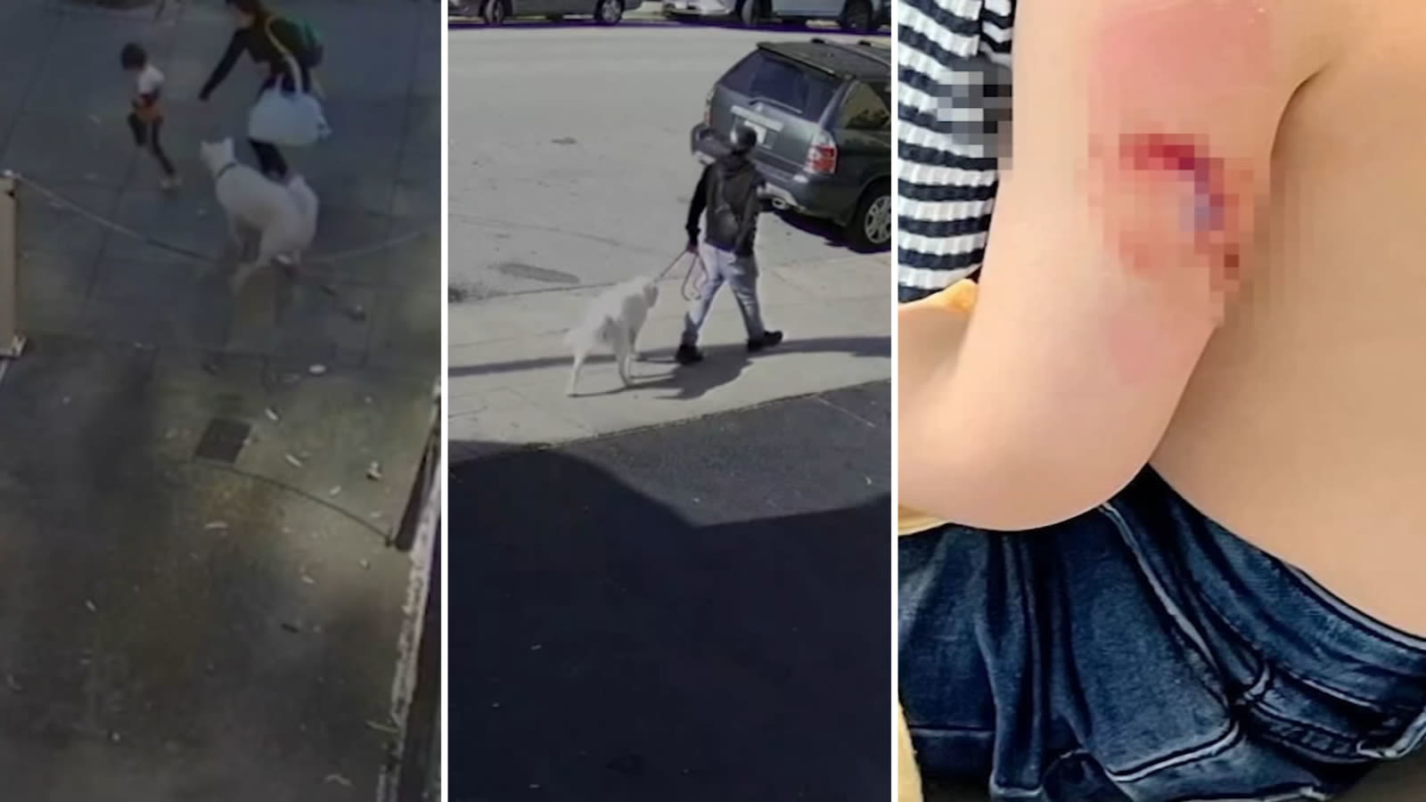 San Francisco family furious after 4-year-old son attacked by dog, owners walk away