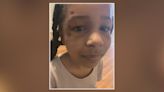 DC mom outraged after 7-year-old daughter came home from school with 2 black eyes