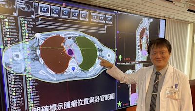 科技助陣抗癌！中榮AI器官圈註 放療成功率突破95％ - 健康