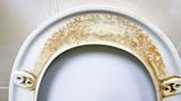 Remove tough toilet seat stains in 8 minutes for good with one item expert loves