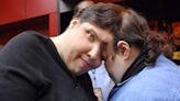 Lori and George Schappell, World's Oldest Conjoined Twins, Dead at 62