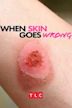 When Skin Goes Wrong