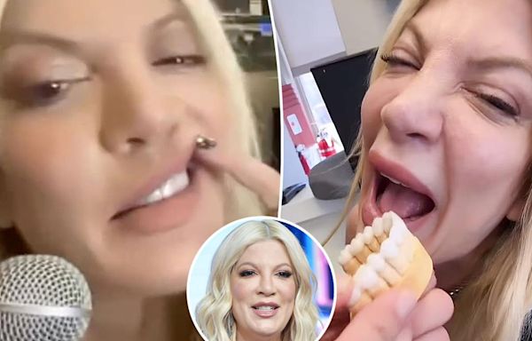 Tori Spelling has ‘never been happier’ since getting veneers to replace her ‘disgusting’ teeth: ‘I smile now’
