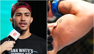 Igor Severino suspended nine months, fined $2K by NAC for UFC biting incident