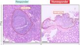 Front-line drug for ulcerative colitis found to have additional mechanism of action that until now remained elusive