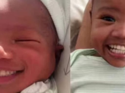 Woman Shares Clip Of Her Baby Born With Teeth, Raises Awareness On This Medical Condition - News18