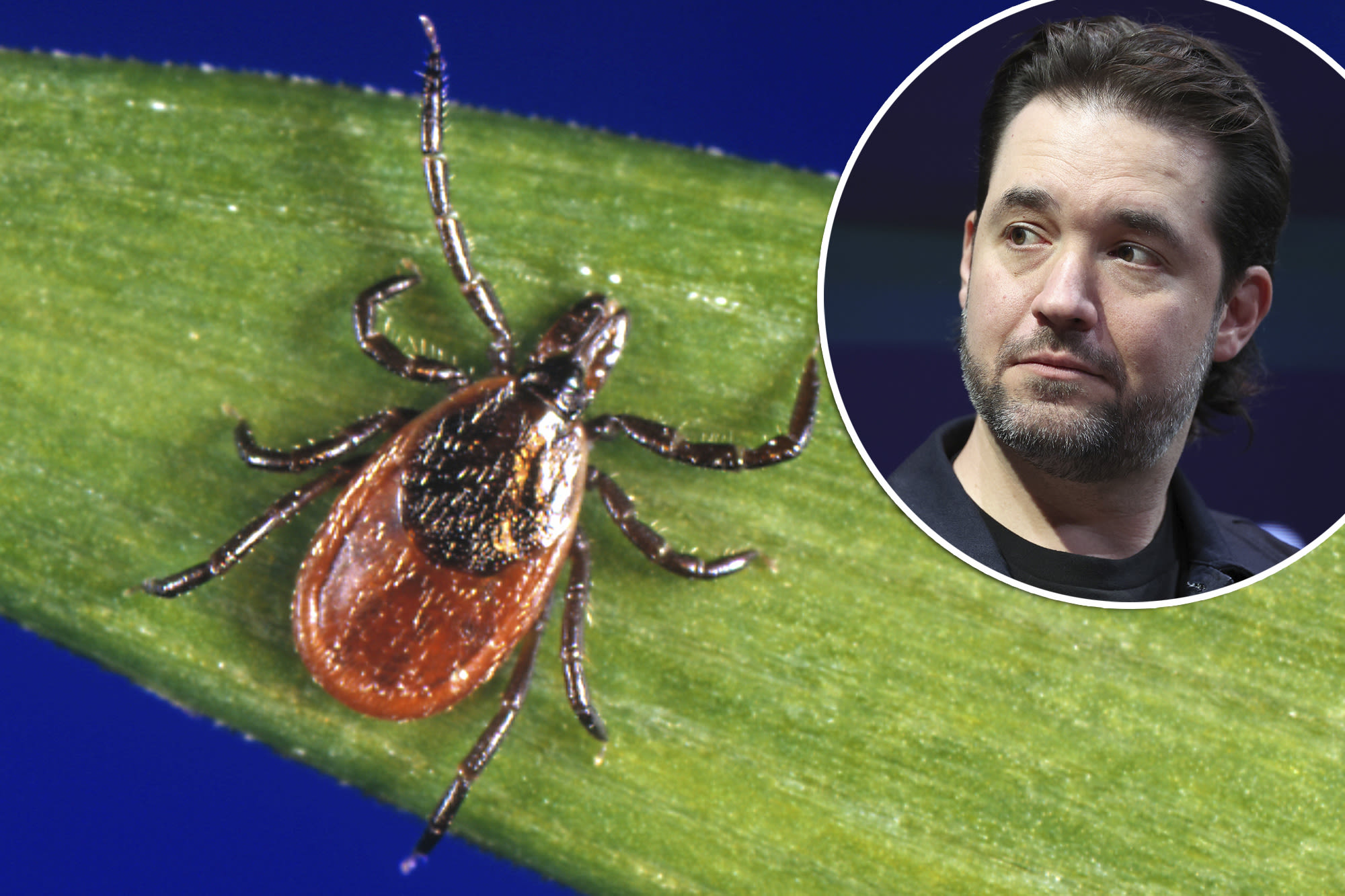 Alexis Ohanian has Lyme disease — everything you need to know about the serious illness