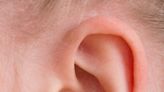 From health to sports—ears can say a lot about you