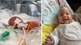 Baby born weighing less than a loaf of bread defeats odds to celebrate 1st birthday