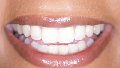 Big event coming up? Brighten your smile with these No. 1 bestselling Crest Whitestrips, on sale for $25