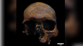 Battered Roman-era skull with signs of violent trauma and a possible brain tumor unearthed in Spain