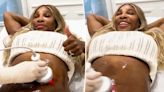 Serena Williams shares ‘amazing’ skin-tightening tummy procedure: ‘Confidence coming back’