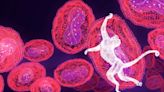 CDC advises mpox may be making a comeback