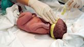 Medical Experts Alarmed by Out-of-Hospital Cesareans in Florida