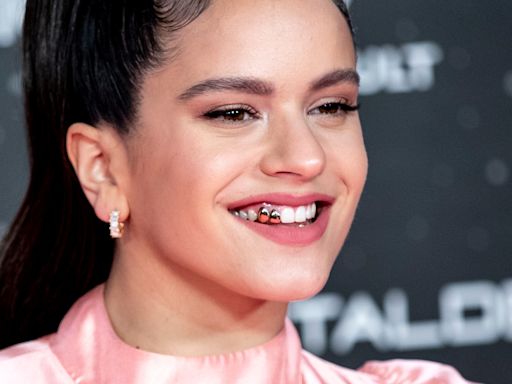 La tendencia de los dientes metálicos a la que se suma Rihanna: una moda pasajera con efectos secundarios