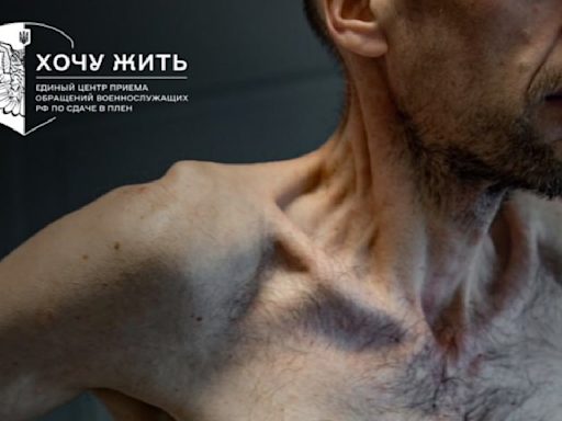 Fotos de prisioneros de guerra ucranianos liberados muestran cuerpos demacrados en condiciones "horripilantes"