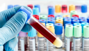 FDA approves new blood test to detect colon cancer