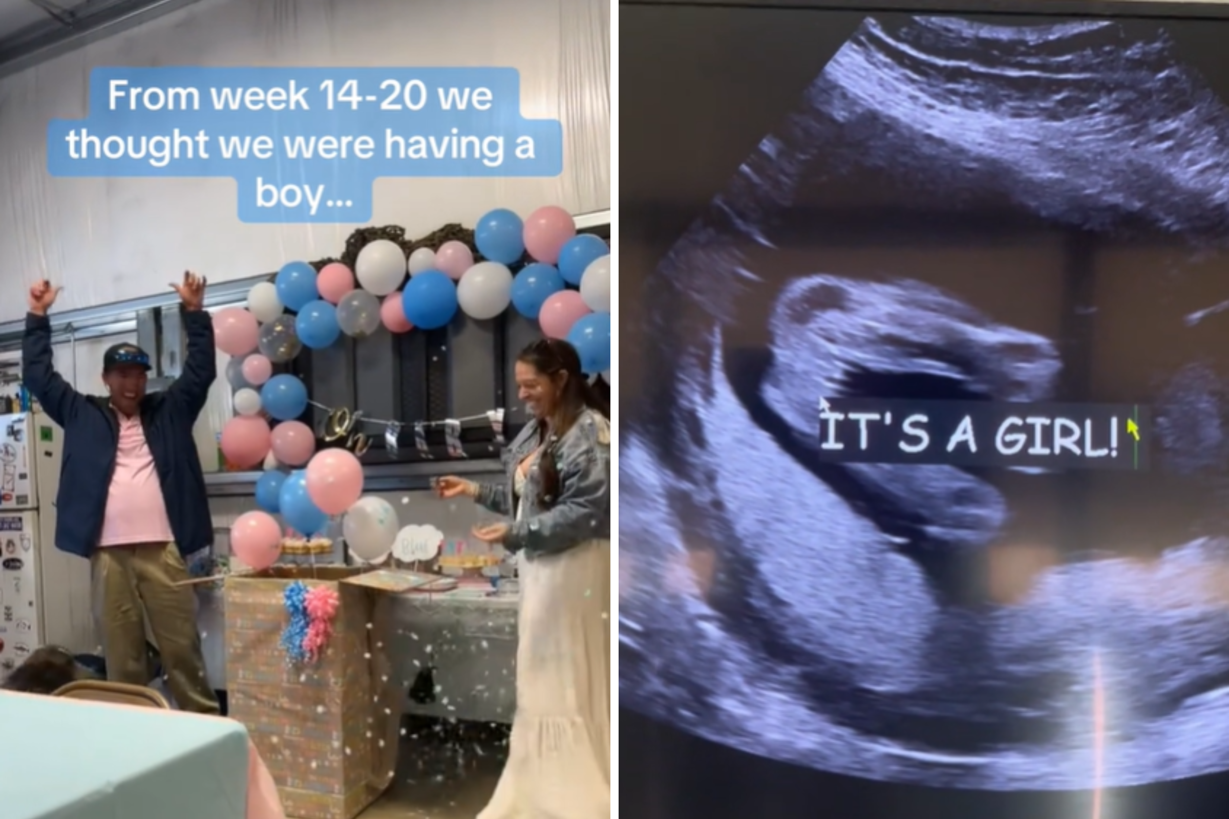Mom-to-be does gender reveal, shops for baby boy—then learns the truth