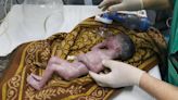 Baby girl saved from dying mother's womb dies just days later in Gaza