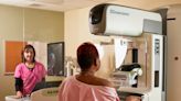 Americans are skeptical about AI in health care. Cincinnati hospitals are already using it