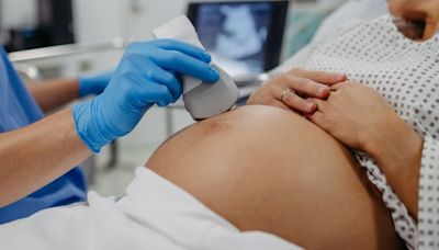 Serious maternal complications linked with use of marijuana before and early in pregnancy, study says
