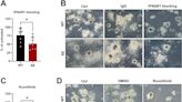 New role of tumor suppressor STAT3β discovered in leukemia