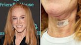 Kathy Griffin undergoes 2nd vocal cord surgery, leaving her unable to speak for 2 weeks