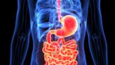COVID infections left thousands of people with acid reflux, chronic constipation, and other stomach issues, scientists say