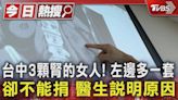 台中3顆腎的女人! 左邊多一套卻不能捐 醫生說明原因｜TVBS新聞 @TVBSNEWS01│TVBS新聞網