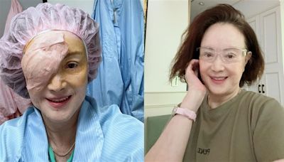 曾PO文求集氣！77歲資深女星「2個月2度動刀」 最新病況曝光