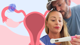 Jamie Otis opens up about having a blocked fallopian tube. What causes it?