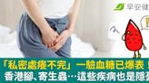 「私密處癢不完」一驗血糖已爆表！香港腳、寄生蟲…這些疾病也是隱憂