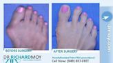 Dr. Richard Moy Outshines Competitors with Innovative Surgical Methodology for Painlessly Removing Bunions - LA Weekly