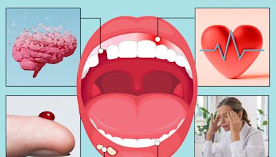 10 things your TEETH can reveal about your health from silent killer to dementia