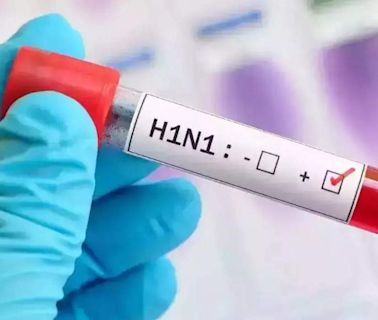 H1N1 Cases Rising in City Despite Drop in Malaria, Dengue, and Lepto | Mumbai News - Times of India