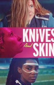 Knives and Skin