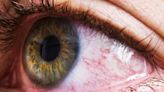 Will My Eyes Ever Go Back to Normal After Graves' Disease?